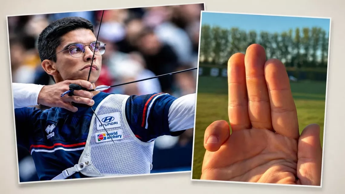 Thomas Chirault identifies hi string fingers as the physical sign that shows he is an archer.